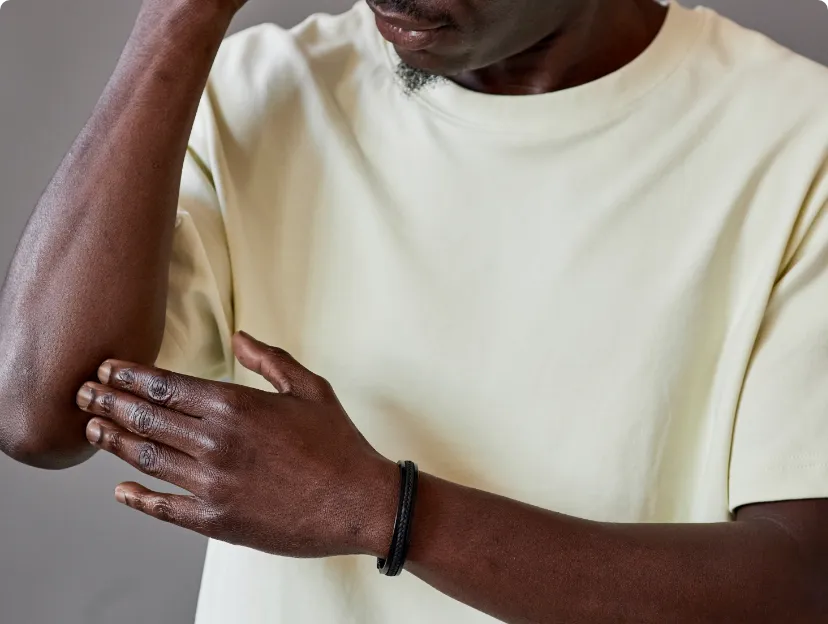 Close-up of a man's elbow revealing symptoms indicative of eczema, a skin condition.